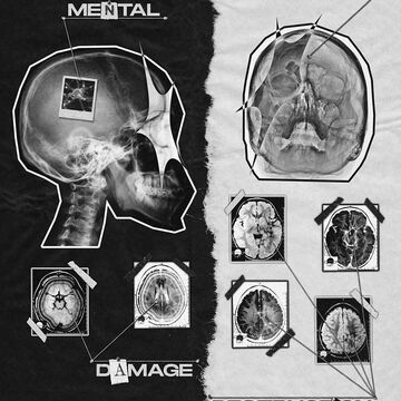 Постер - Mental